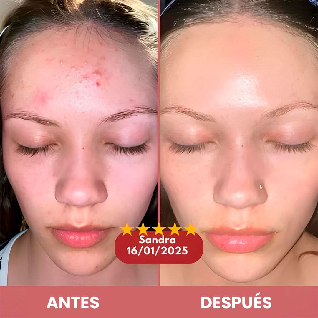 Peel Glow Rice Duo – Exfoliación + Hidratación