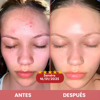 Peel Glow Rice Duo – Exfoliación + Hidratación
