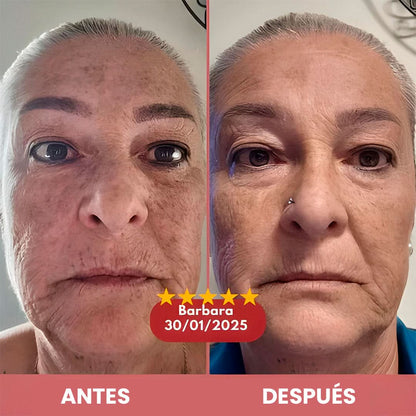 Peel Glow Rice Duo – Exfoliación + Hidratación