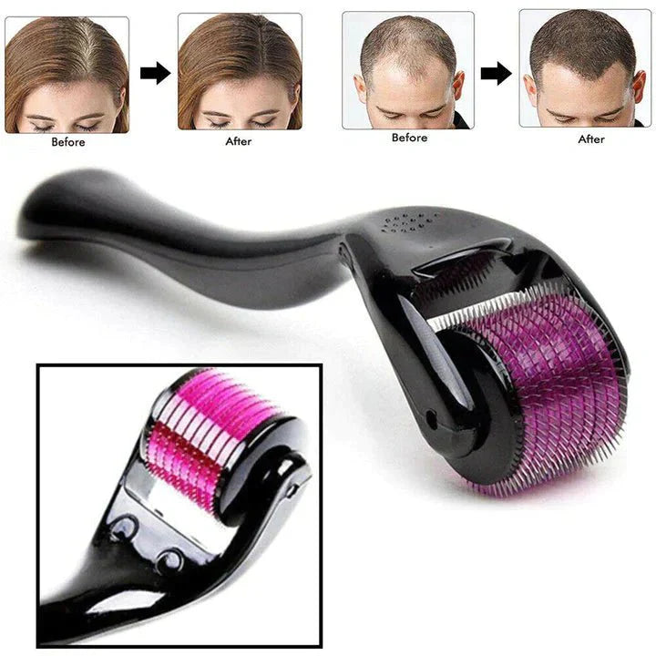 Derma Roller - Rodillo Estimulador Crecimiento - Nebula