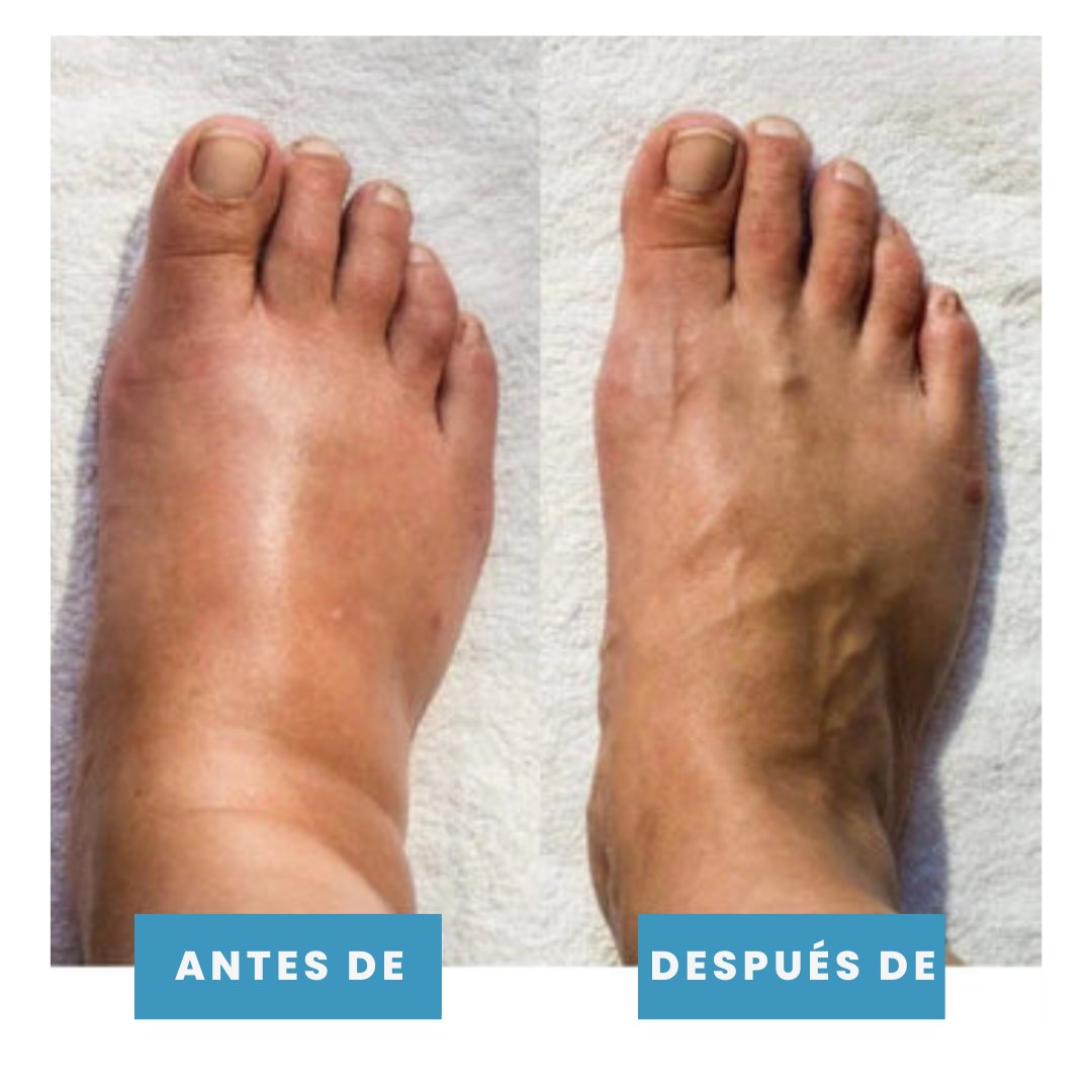 Postur™- Masajeador de pies