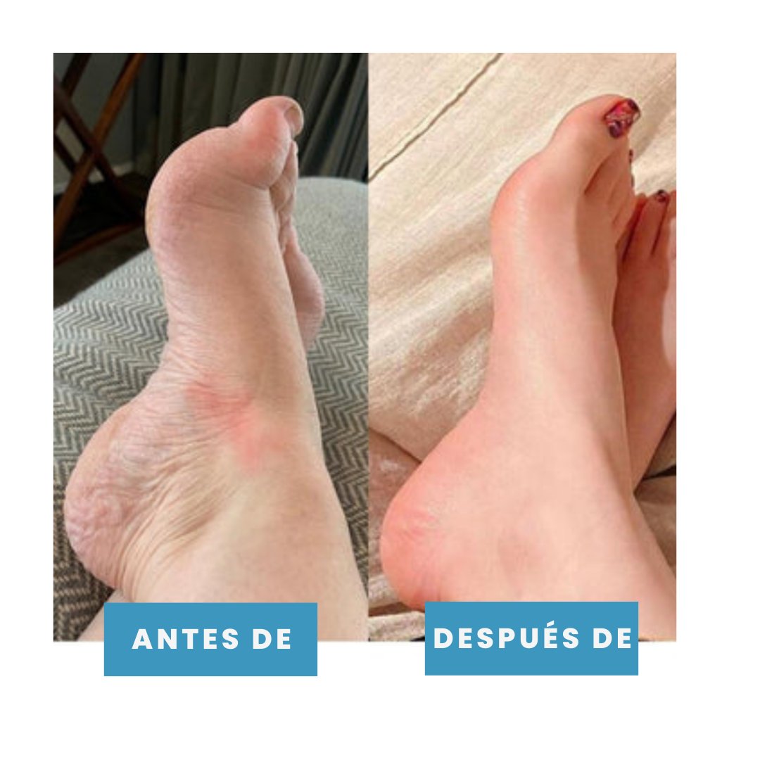 Postur™- Masajeador de pies